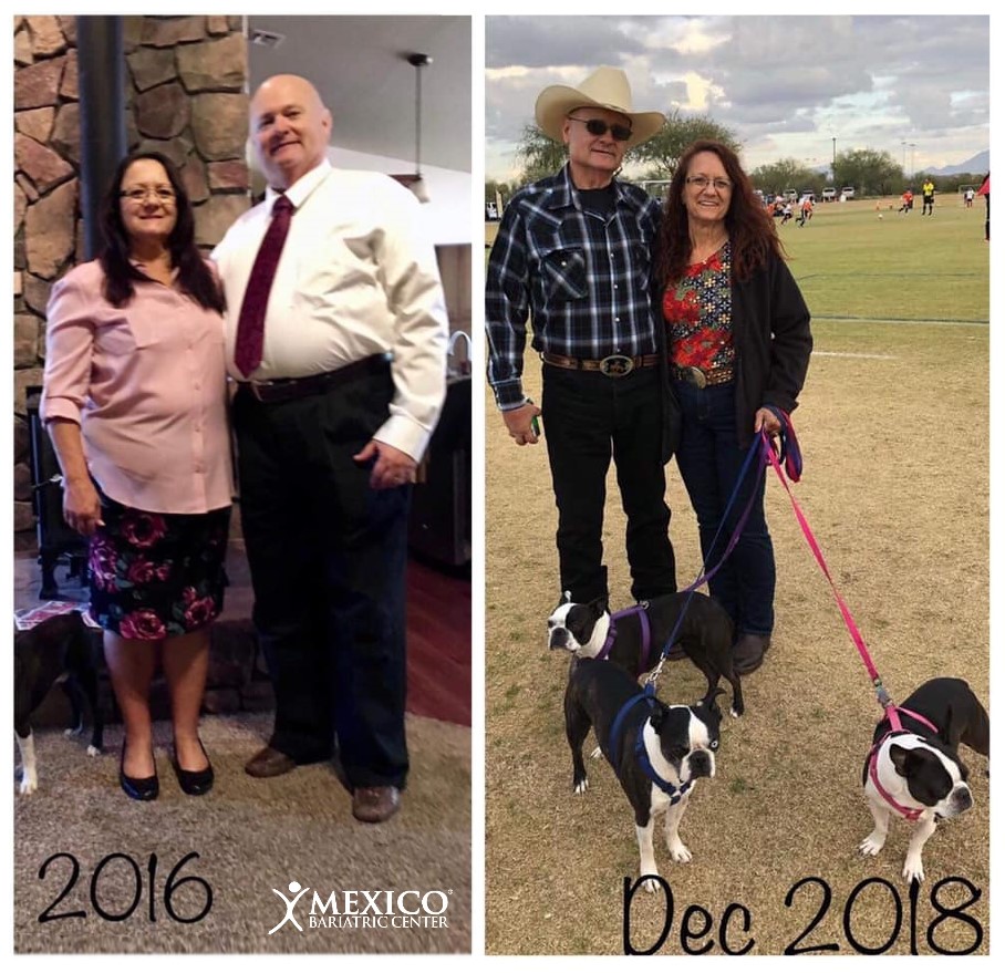 Vicki and her husband before and after surgery - Dr Gutierrez